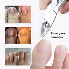 Load image into Gallery viewer, Last Day Promotion（50% OFF ）Medical-grade Nail Clippers - Libiyi